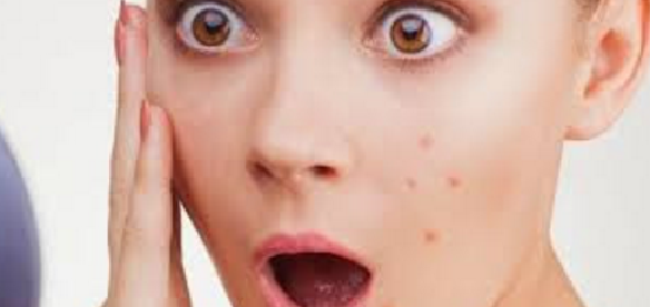  Berapa seringkah anda memegang wajah dalam sehari 5 Kebiasaan Memegang Muka Bikin Wajah Jelek dan 4 Cara Mencegah Iritasi Wajah