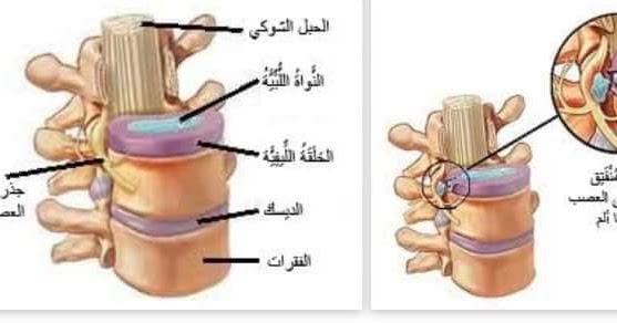 ما هو القرص وأسبابه وعلاجه