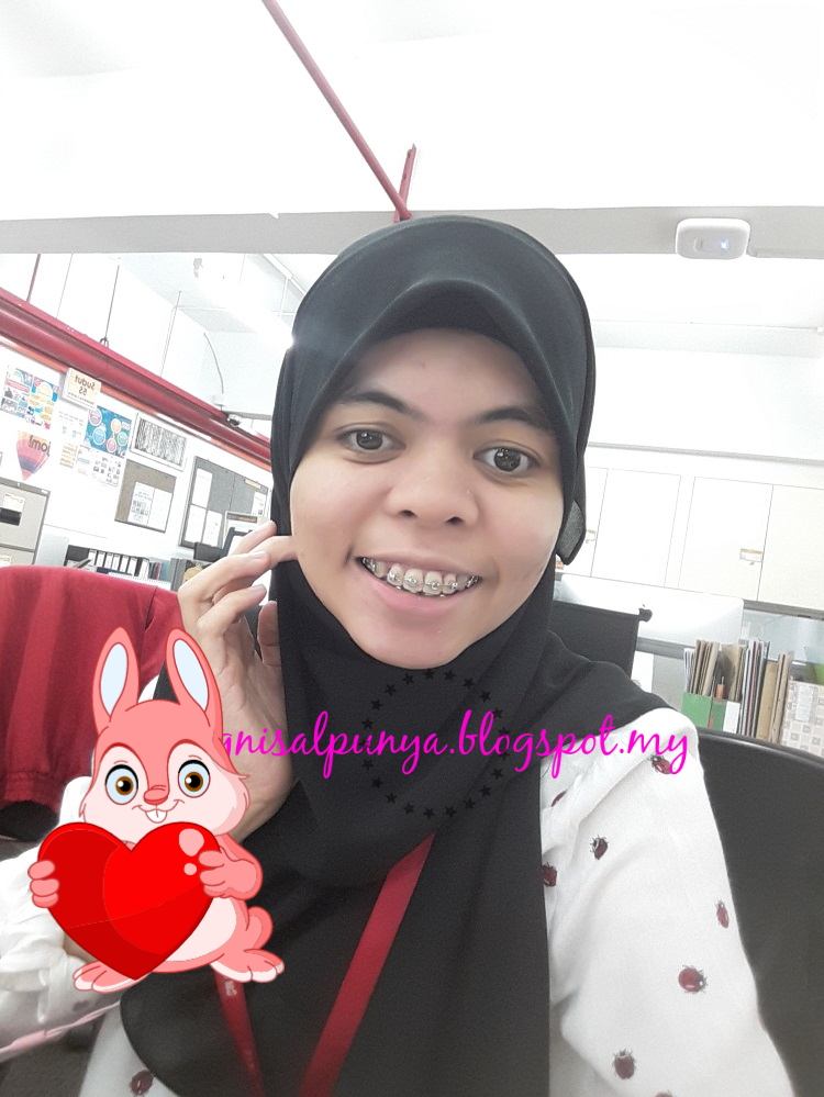 Blog Sal Braces Journey Part 8 Cabut braces!!!