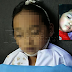 Budak 7 Tahun Maut Dipatuk Ular
