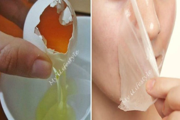 Eliminar el vello no deseado de forma permanente en el hogar sin utilizar productos químicos - Es totalmente sin dolor! Eliminar el vello no deseado de forma permanente en el hogar sin utilizar productos químicos - Es totalmente sin dolor!