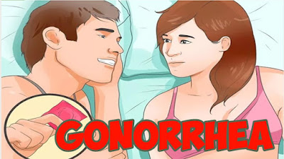 Nanah Pada Kemaluan Perempuan Nanah Pada Kemaluan Perempuan