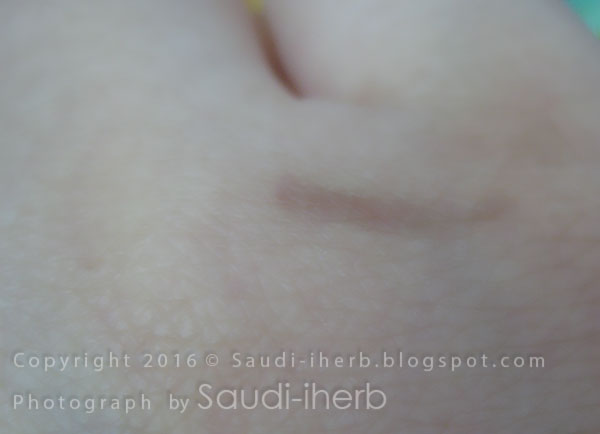 تجربتي ازالة الحروق بعسل المانوكا آي هيرب بالعربي من السعودية تجارب منتجات ايهيرب