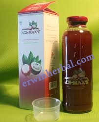 Penyebab, Gejala serta Pengobatan Kista Ovarium Penyebab, Gejala serta Pengobatan Kista Ovarium