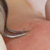 Une esthéticienne plante des pinces dans la peau d'une femme, ce qu'elle en retire est surprenant!