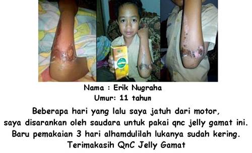 Obat Penumbuh Jaringan Kulit Dan Daging Tradisional Obat Penumbuh Jaringan Kulit Dan Daging Tradisional