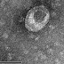 Coronavirus spreads quickly in California, New York; State of Emergency Declared