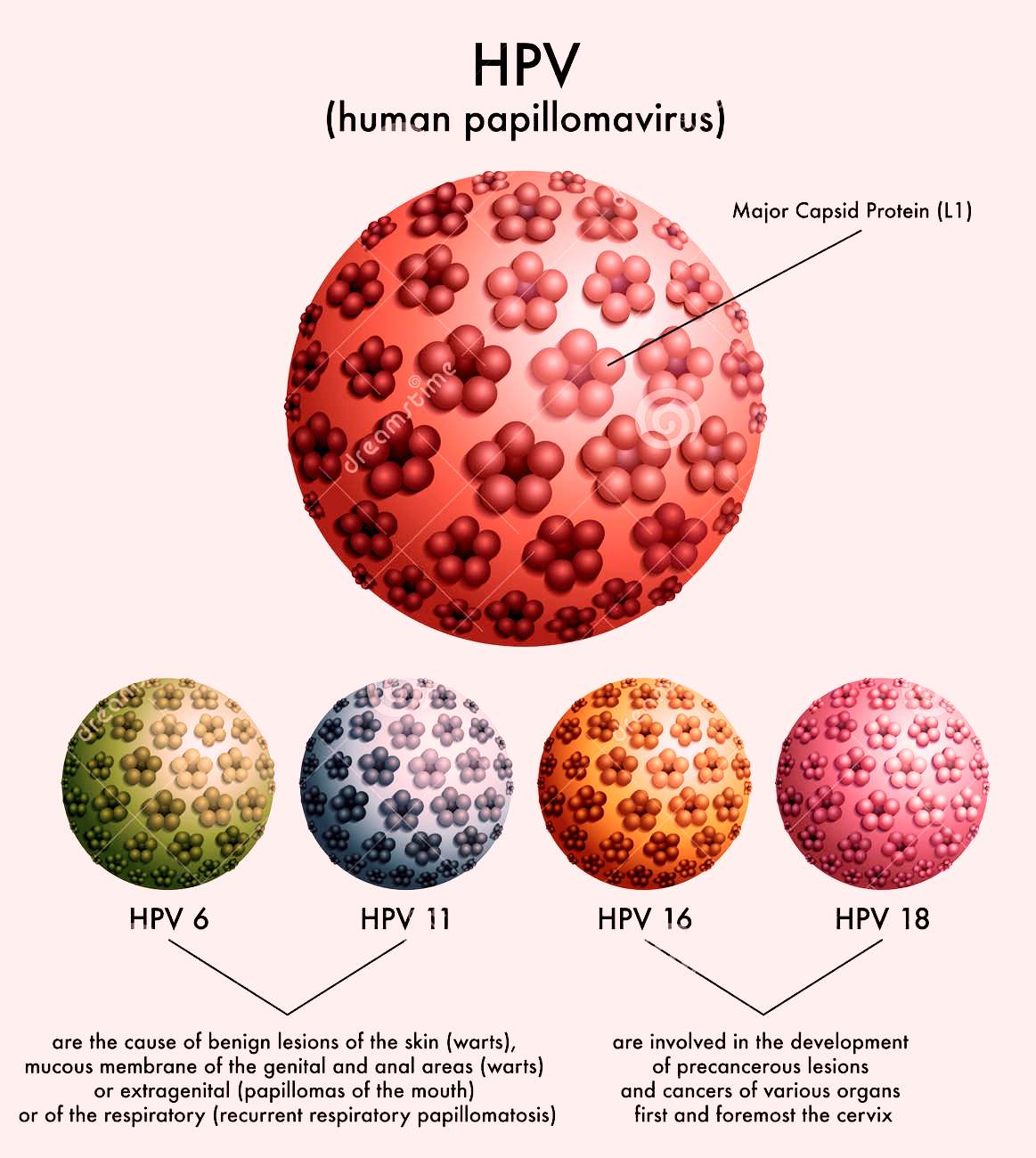 Papilloma virus e hiv, Virusul HPV. Tipuri de leziuni HPV: Diagnostic, tratament si prevenire