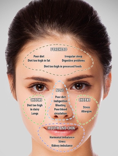 Acne On Chin And Jaw Meaning Feedtheking