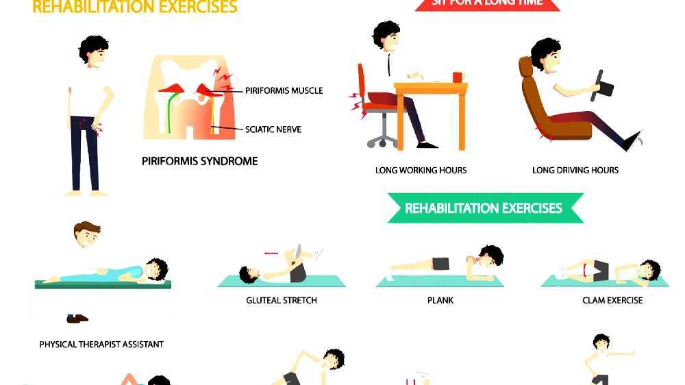Piriformis Syndrome Piriformis Syndrome