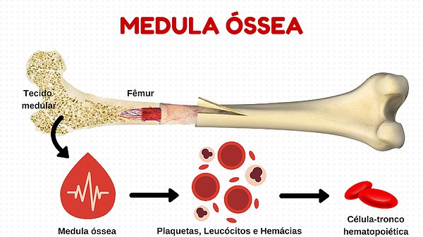 Exame de medula ossea