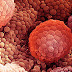 PROSTATE CANCER EVERY MAN'S PROBLEM