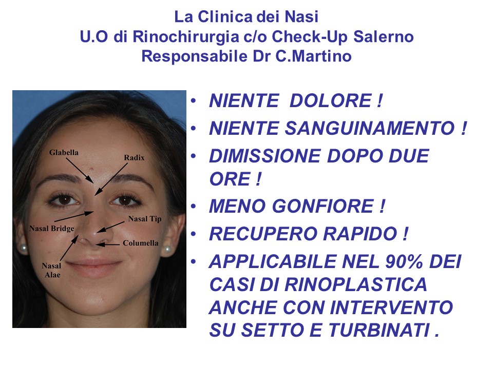 La Clinica Dei Nasi Dr Martino Salerno Rinoplastica Tecnica Ibrida In Anestesia Locale