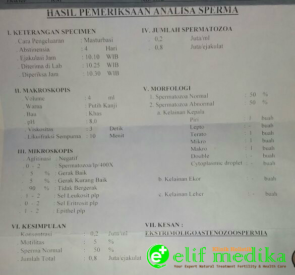 Ekstrim OligoAsthenozoospermia, Konsultasi, Penyebab & Pengobatan Ekstrim OligoAsthenozoospermia, Konsultasi, Penyebab & Pengobatan