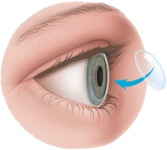 http://www.amrithospital.com/specialities/ophthalmology/cornea-services/