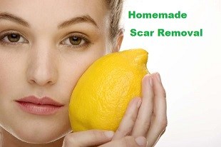 How To Make Homemade Scar Removal Treatment How To Make Homemade Scar Removal Treatment