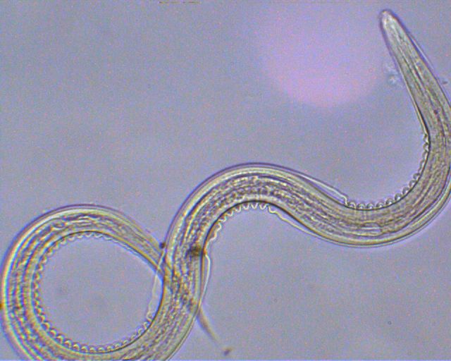 Necator americanus Microbiology Lab Notes