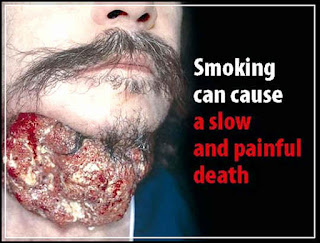 Bahaya lain merokok