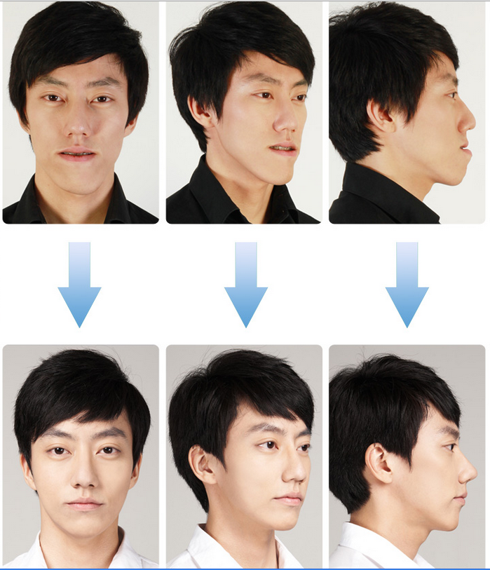 BK Plastic Surgery: [BK Plastic Surgery] Jun hee's real story-his life