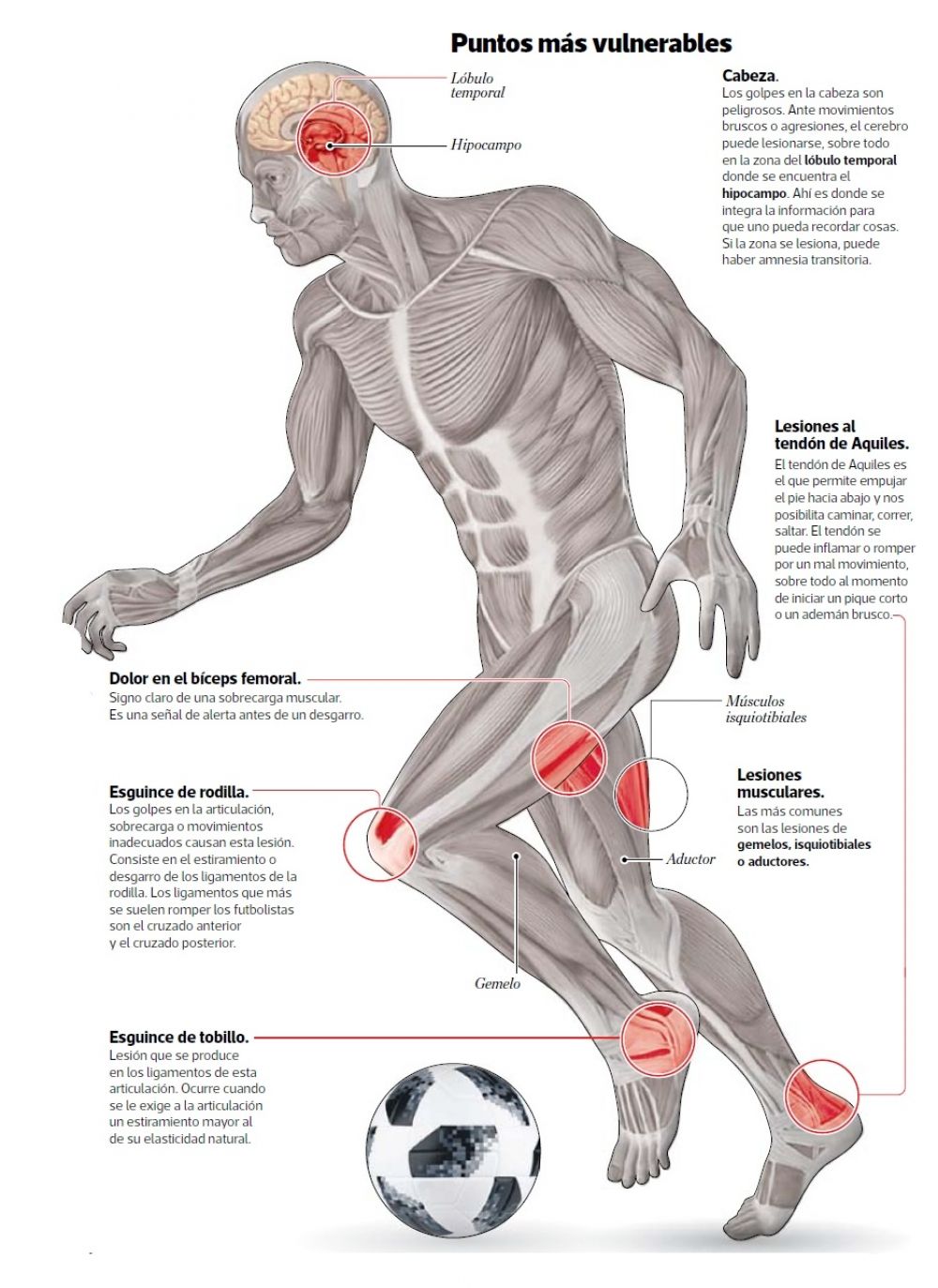 Dolor del biceps femoral