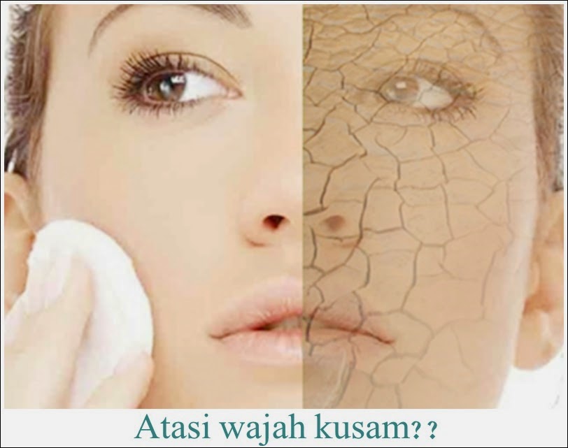 Atasi wajah kusam dan flek hitam Atasi wajah kusam dan flek hitam