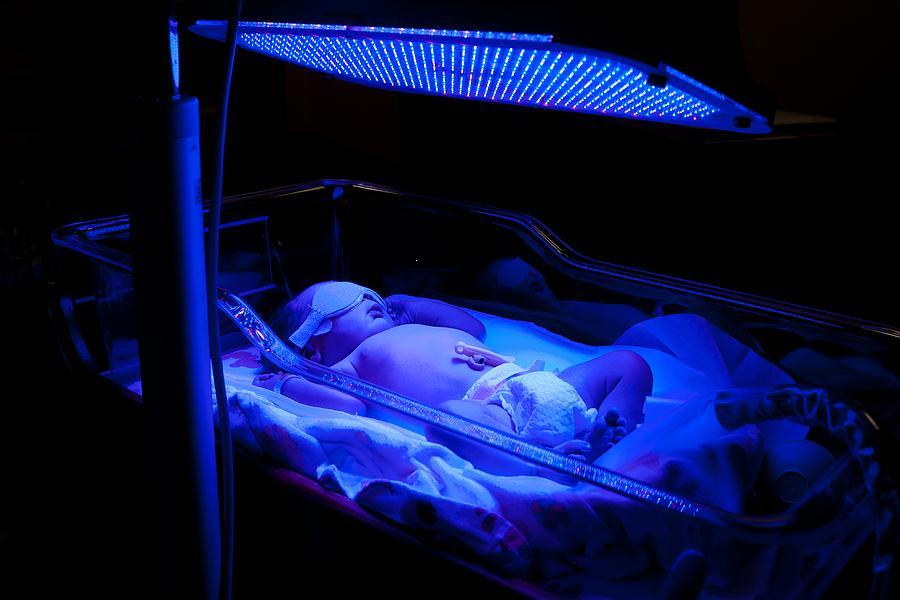 How Neonatal Phototherapy for Babies Works