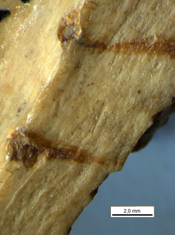 Evidence of cannibalism found in Mesolithic Spain Evidence of cannibalism found in Mesolithic Spain