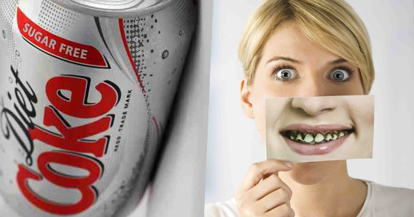 what does diet coke do to your teeth what does diet coke do to your teeth
