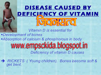 diseases caused by deficiency of vitamins minerals%2Bempsckida