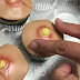 Kue Aneh Mirip Jerawat Atau Bisul, Mau Coba Memakan Kue Menyeramkan ini