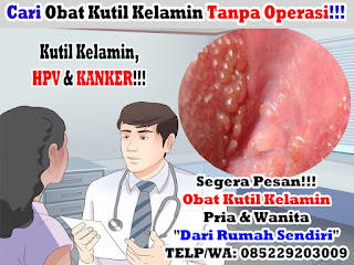 Obat Kutil Kelamin