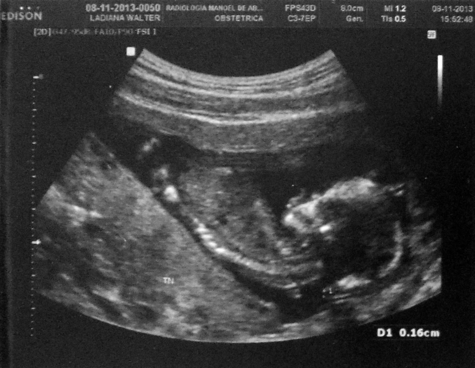 Diário da Barrigudinha 16 semanas Fotos bebê