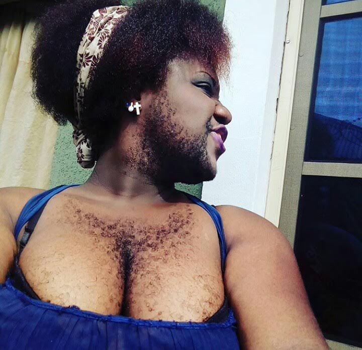 Most Hairy Woman 103
