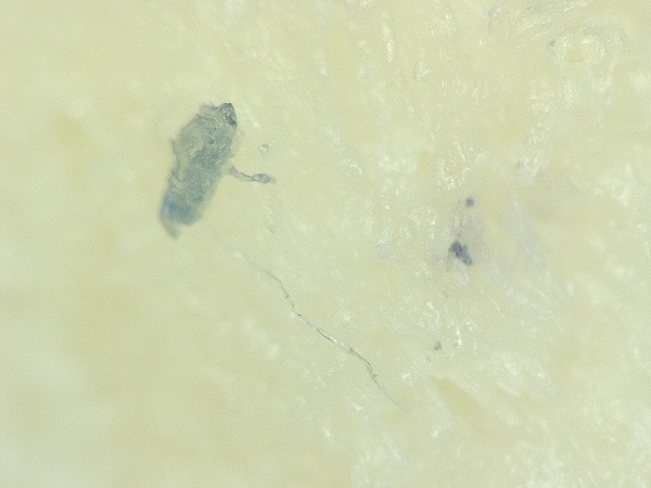 McDonald's Chicken McNuggets found to contain mysterious fibers, hair-like structures; Natural News Forensic Food Lab posts research photos, video McDonald's Chicken McNuggets found to contain mysterious fibers, hair-like structures; Natural News Forensic Food Lab posts research photos, video