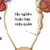 Chứng bệnh thận ứ nước có nguy hiểm không? Chứng bệnh thận ứ nước có nguy hiểm không?