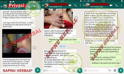TERBUKTI ! 6 Bahan Alami Ini Bisa Percepat Penyembuhan Luka TERBUKTI ! 6 Bahan Alami Ini Bisa Percepat Penyembuhan Luka