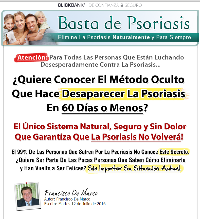 Que tal la eccema en las manos y de que