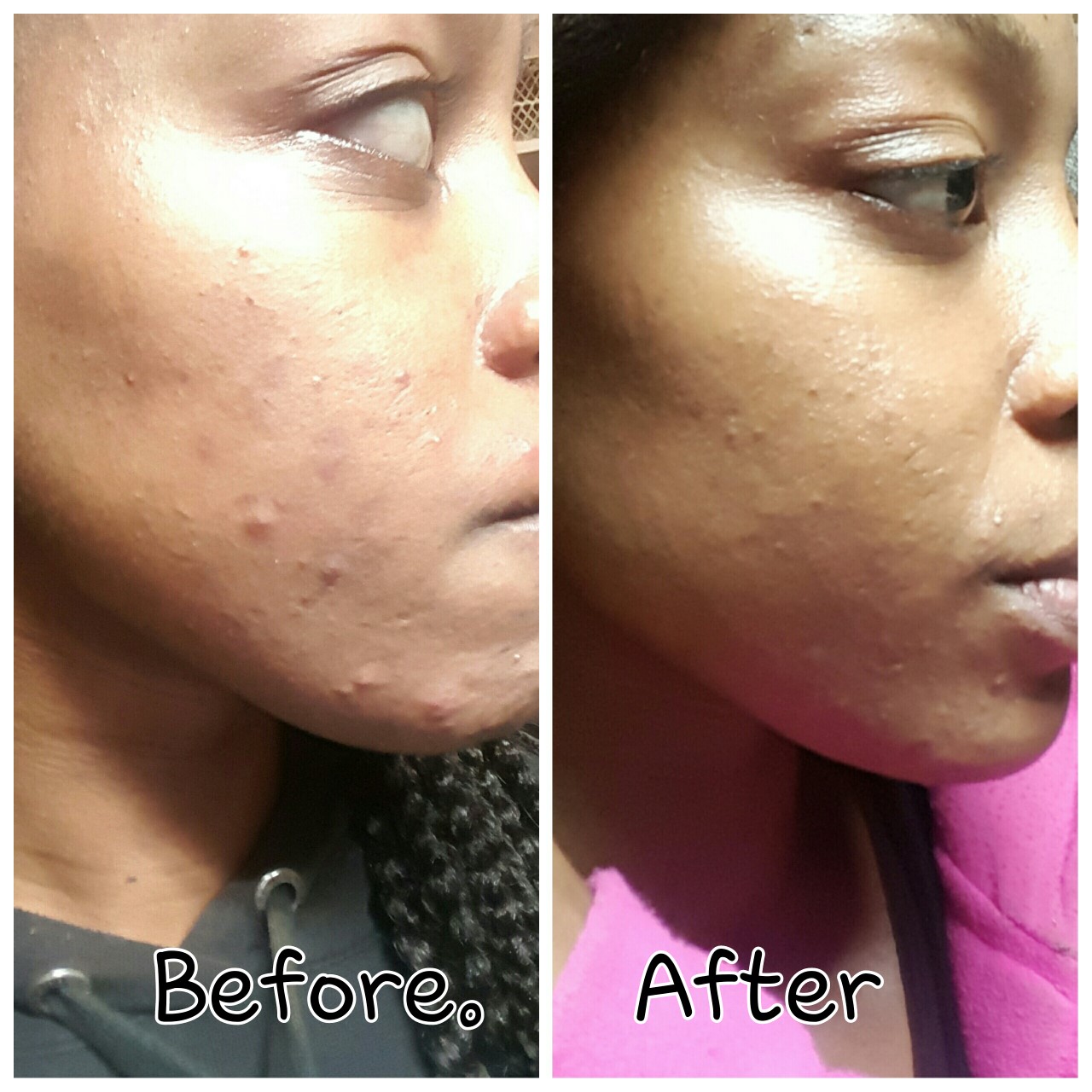 Makeup Artist's Choice Before/After Pics and Testimonials