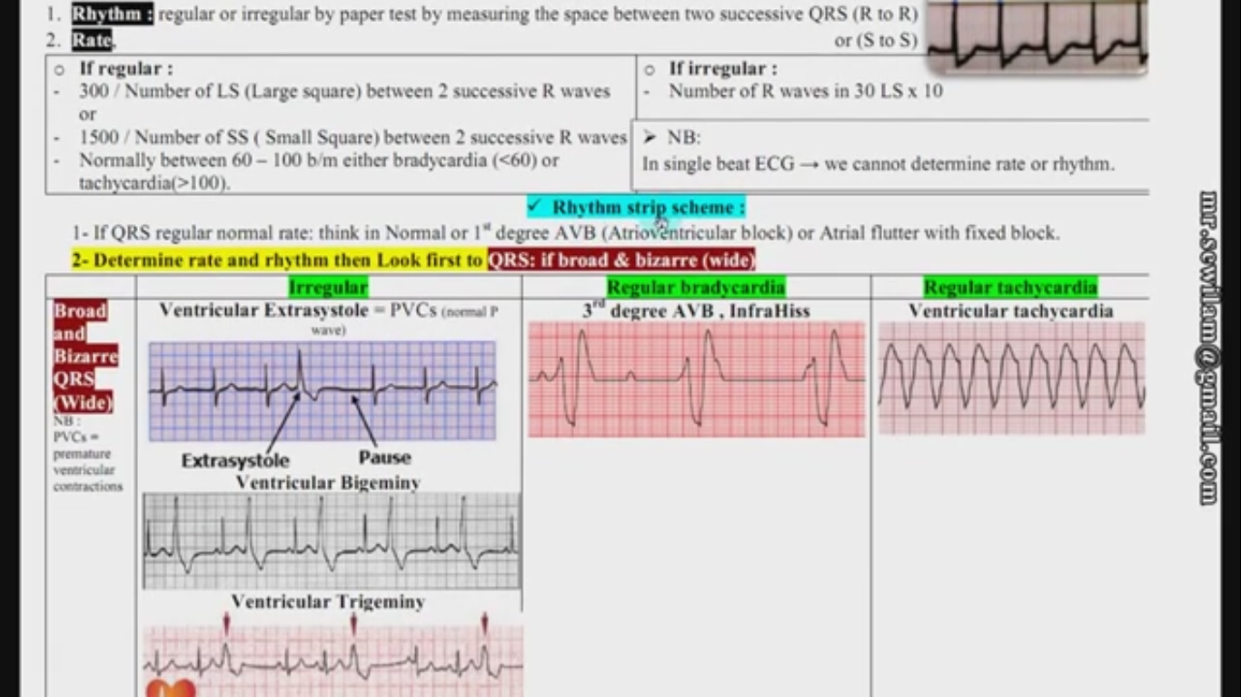 hampton ecg made easy pdf free