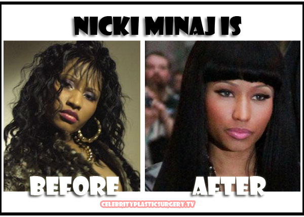 welcome to jenny&rsquo;s blog: Nicki Minaj: Before & after surgeries