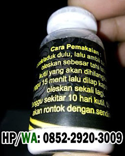 Obat Kutil Kelamin Obat Kutil Kelamin