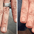 30 Times Tattoo Artists Did An Awesome Job Covering Up People's Scars And Birthmarks