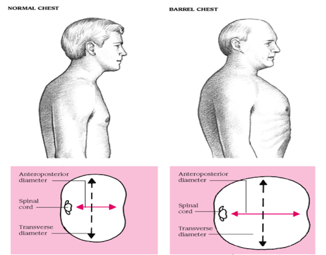 MASOHIPUNK PEMERIKSAAN THORAKS