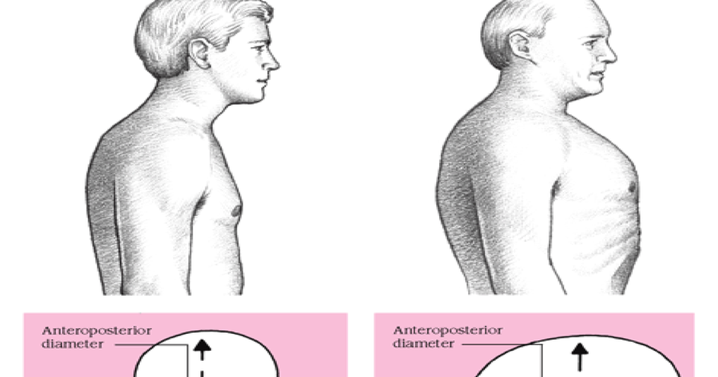 MASOHIPUNK PEMERIKSAAN THORAKS