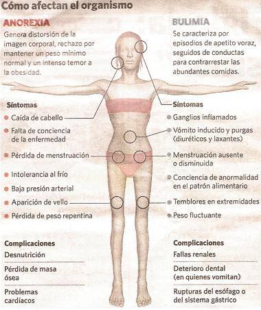 Esofagitis y perdida de peso repentina Esofagitis y perdida de peso repentina