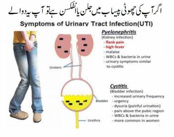 cipro treatment of urinary tract infection