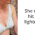 18 Lightning Strike Survivors Reveal Their Shocking Markings
