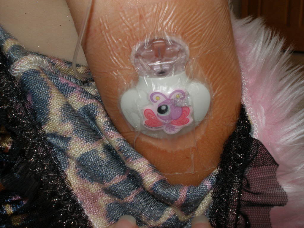Eu, meu filho e o Diabetes PROTE u00c7ÃO PARA A C u00c2NULA DA BOMBA DE INSULINA PISCINA Armario Sala De Tv ~ Eu, meu filho e o Diabetes PROTE u00c7ÃO PARA A C u00c2NULA DA BOMBA DE INSULINA PISCINA