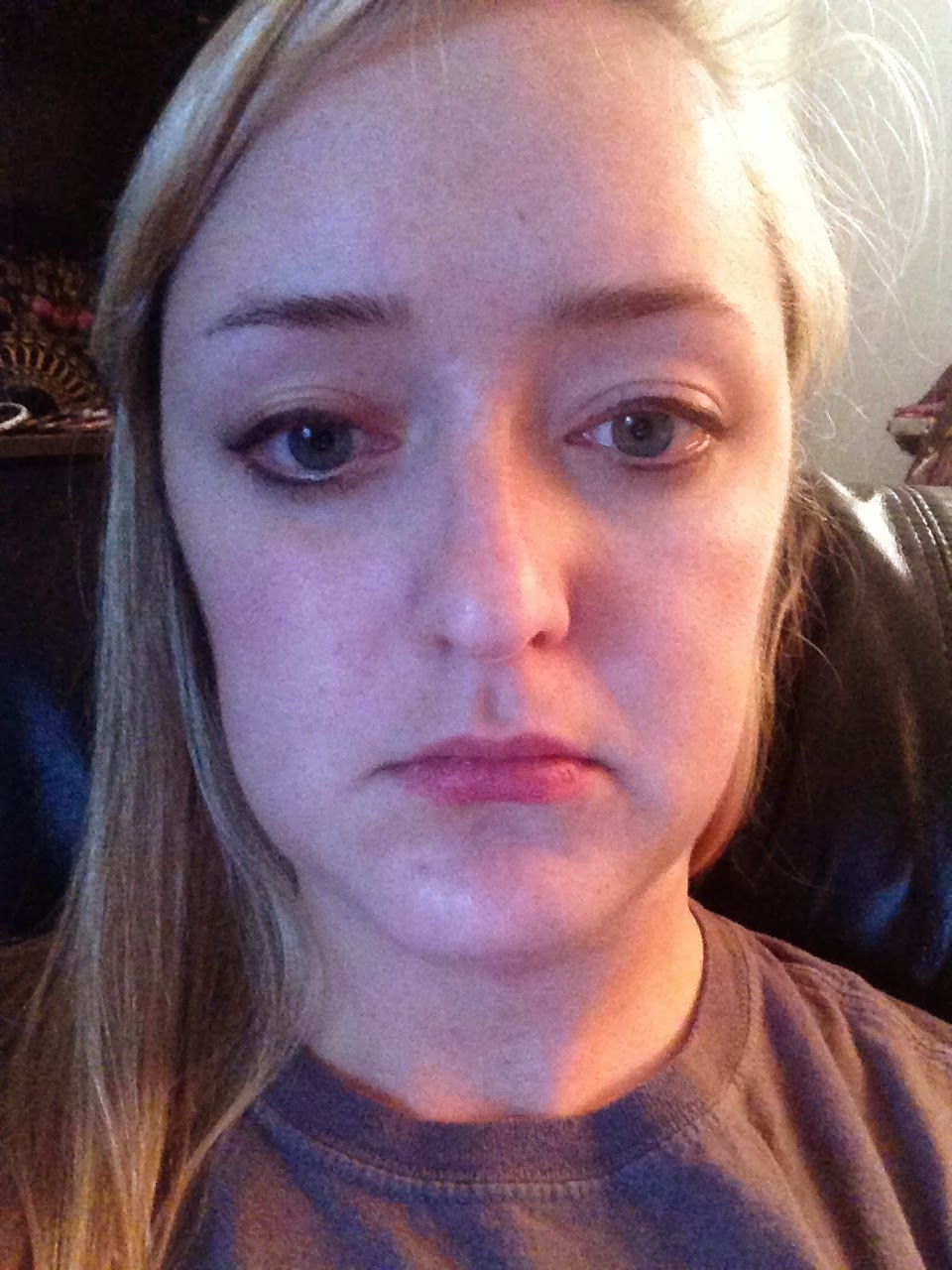 Wisdom Tooth Fiasco My Bout With Osteomyelitis