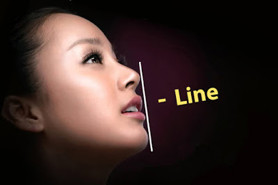 Lưu ý khi chọn trung tâm nâng mũi S Line Hàn Quốc Nang-mui-s-line-boc-sun